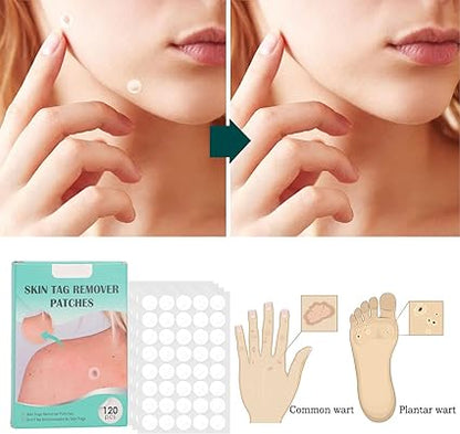 Parches Eliminación de Lunares - additional image 10